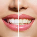 oral microbiome health
